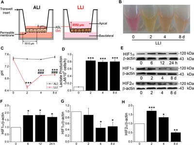 Airway Basal Cells Mediate Hypoxia-Induced EMT by Increasing Ribosome Biogenesis